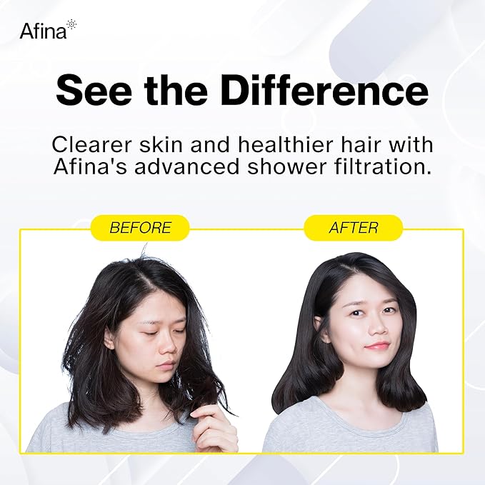 Afina Filtered Shower Head - Water Softener Showerhead with KDF-55 Filter for Hard Water - High Pressure Rain Fall Experience - Universal Fit - Matte Black